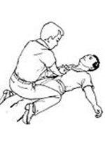 illustration of Heimlich maneuver with the person laying on the ground