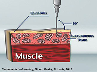 A diagram about injections