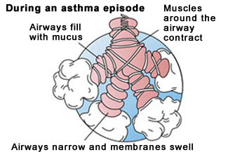 During an asthma episode